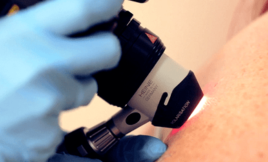 Diagnostične metode za plantarno bradavico